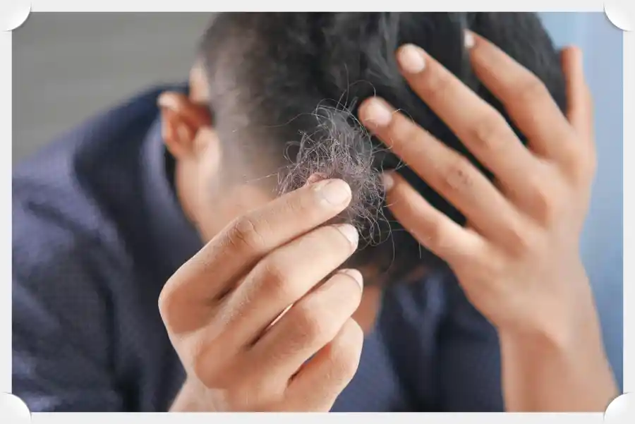 hair-implant-모발이식-1